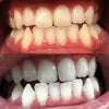 Tandenbleekstrips Actieve koolstofstrips om tanden witter te maken