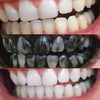 Tanden bleken - tanden bleken met actieve kool
