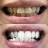 Tanden bleken PAP+ Strips