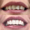 Tanden Whitening Color Corrector