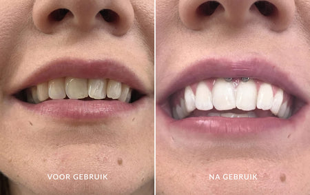 gid://shopify/MediaImage/71710400577885