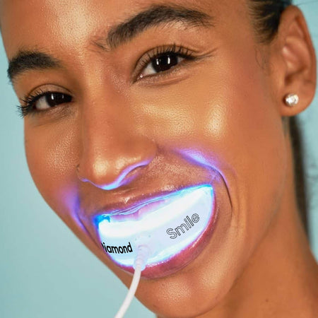 Diamond Smile Power+ Telefoonbleekmiddel Mondstuk LED Rail 