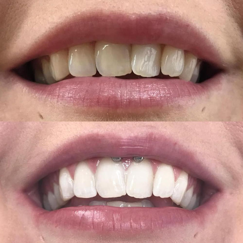 Whitening Mondspoeling iD+