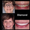 Whitening Mondspoeling iD+