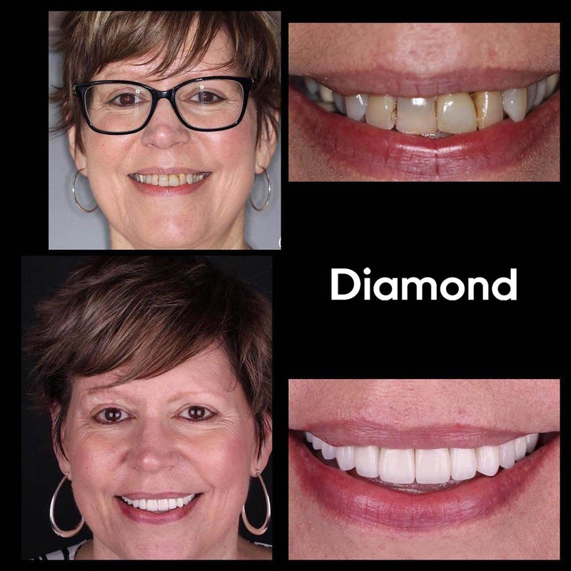 Whitening Mondspoeling iD+