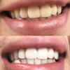 Tand Whitening Kleurcorrectie Schuim om tanden witter te maken